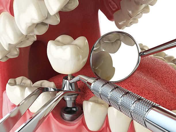 Best Emergency Dental Surgery in Fontana, CA
